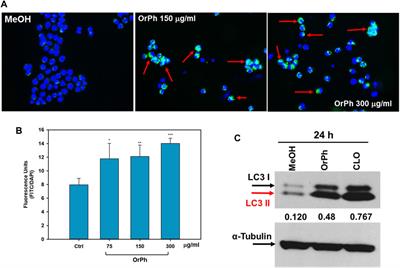 An organic extract from ascidian Ciona robusta induces cytotoxic autophagy in human malignant cell lines